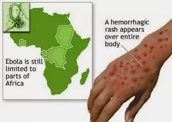Update on the Ebola Virus case in Lagos